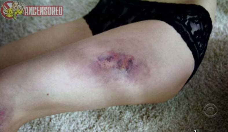 Katie Gill naked breasts